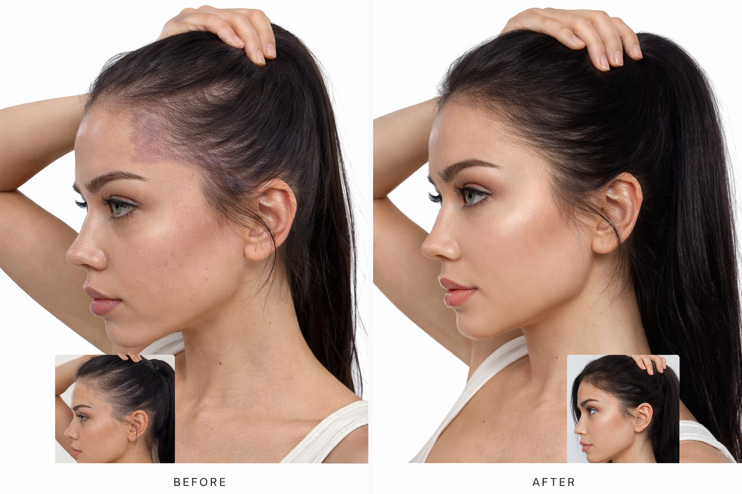 Sherlift™ Hair Growth Serum