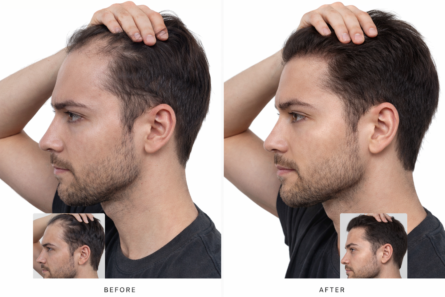 Sherlift™ Hair Growth Serum